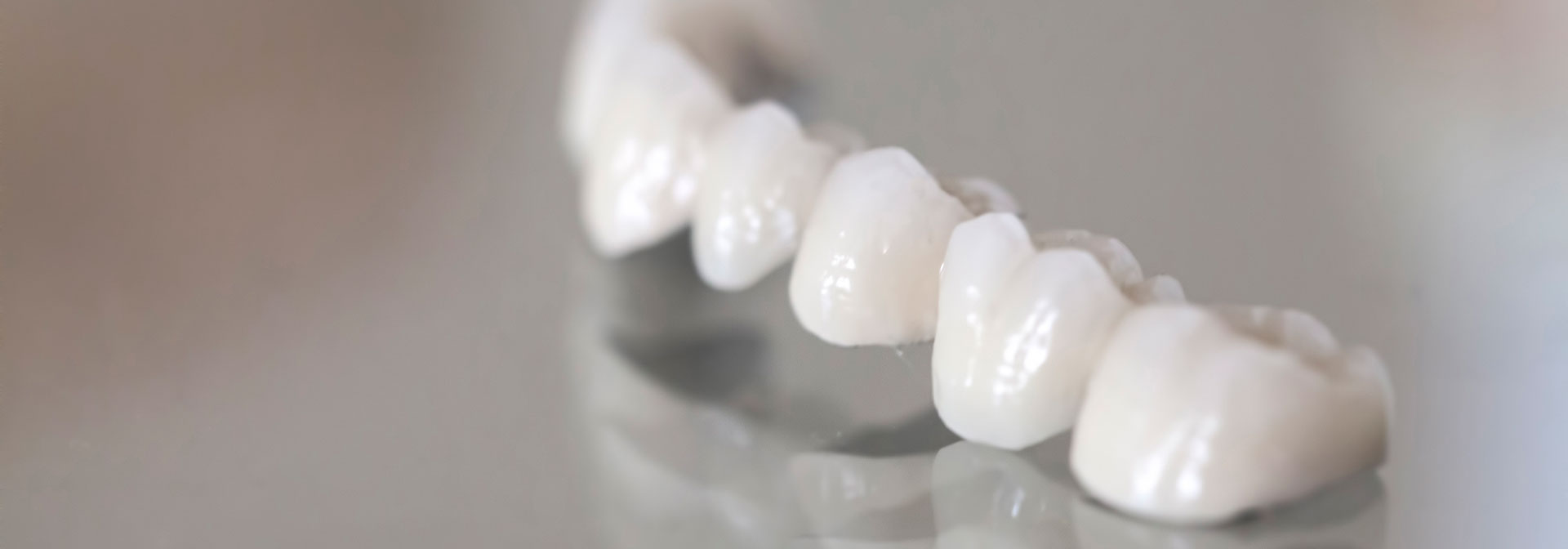 ブリッジ治療