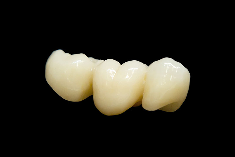 ジルコニアブリッジ