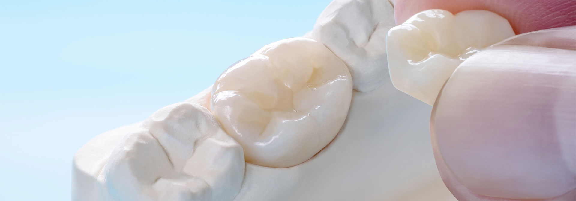 セラミック治療