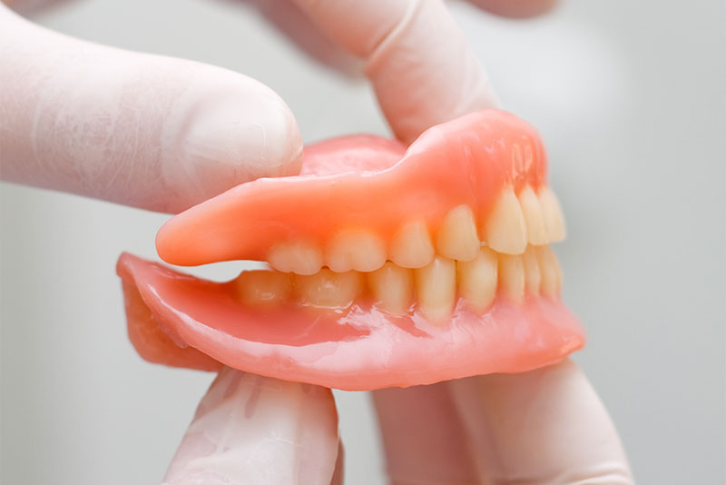 入れ歯の再製作について