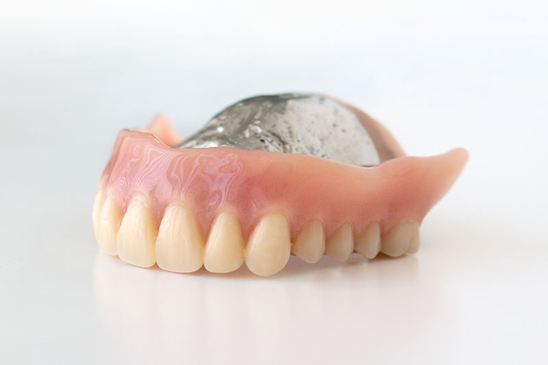 金属床義歯