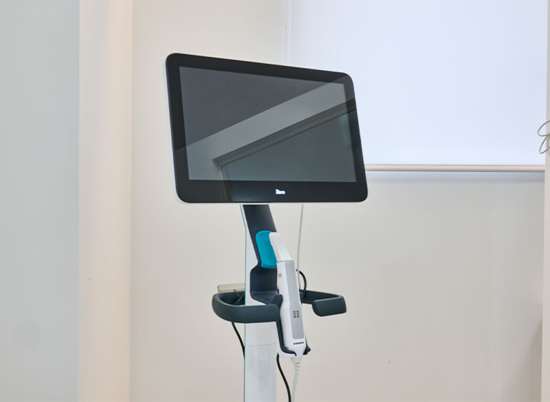 3D口腔内スキャナー