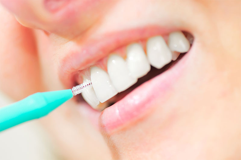 徹底したセルフケア