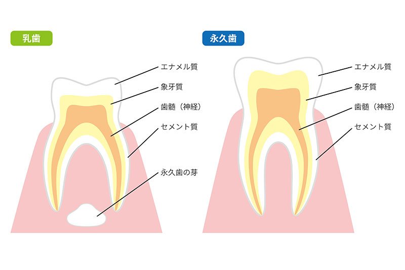 乳歯のエナメル質が薄い