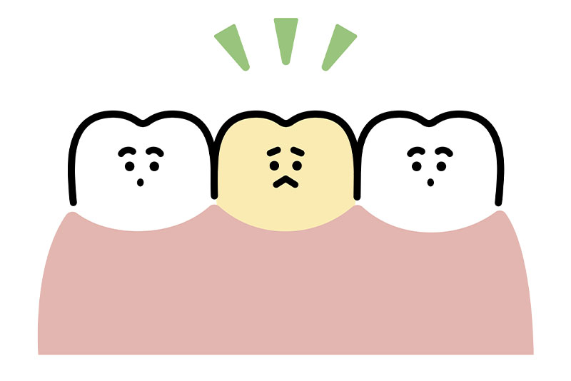 永久歯が変色したり、形が悪くなる