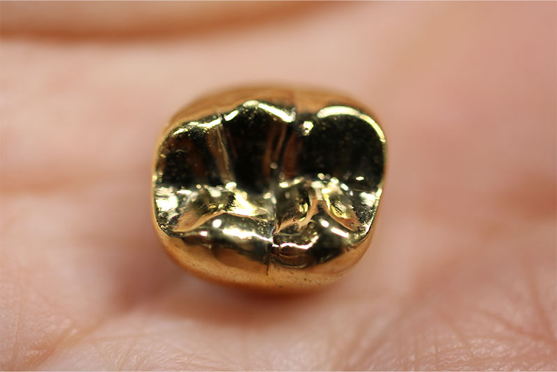 ゴールドクラウン