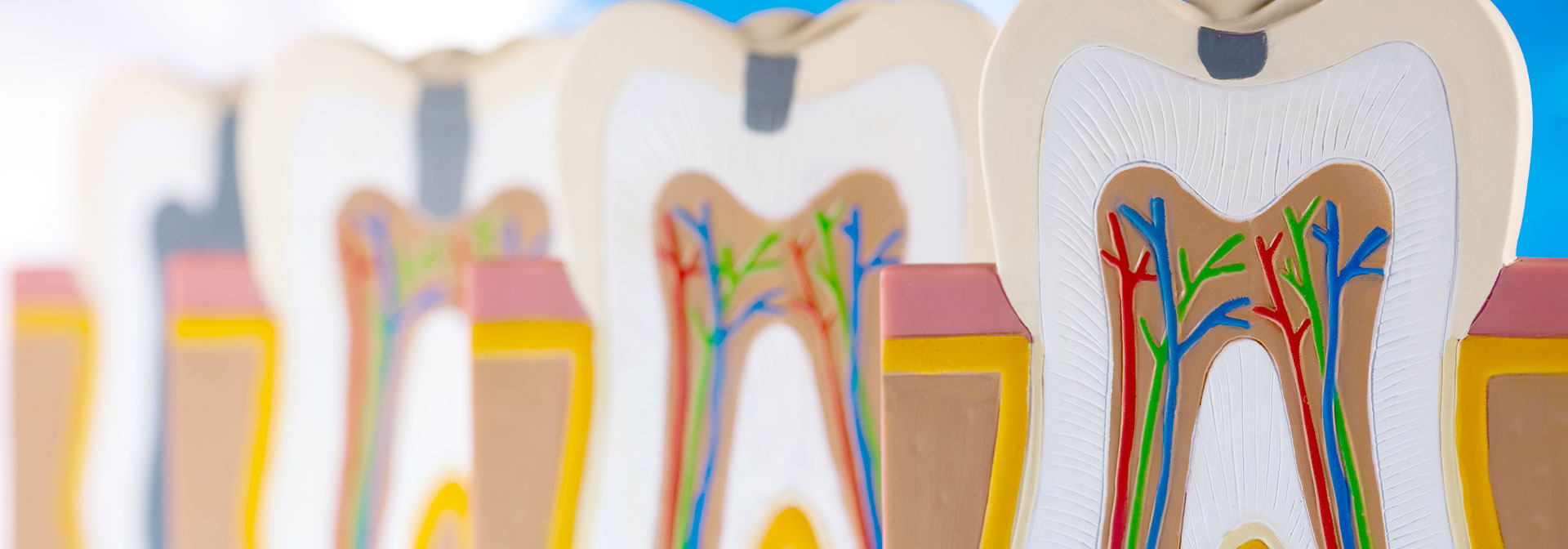 歯の神経を残す治療