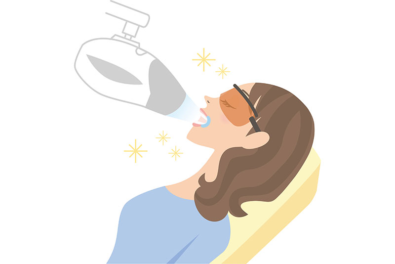 オフィスホワイトニングの流れ