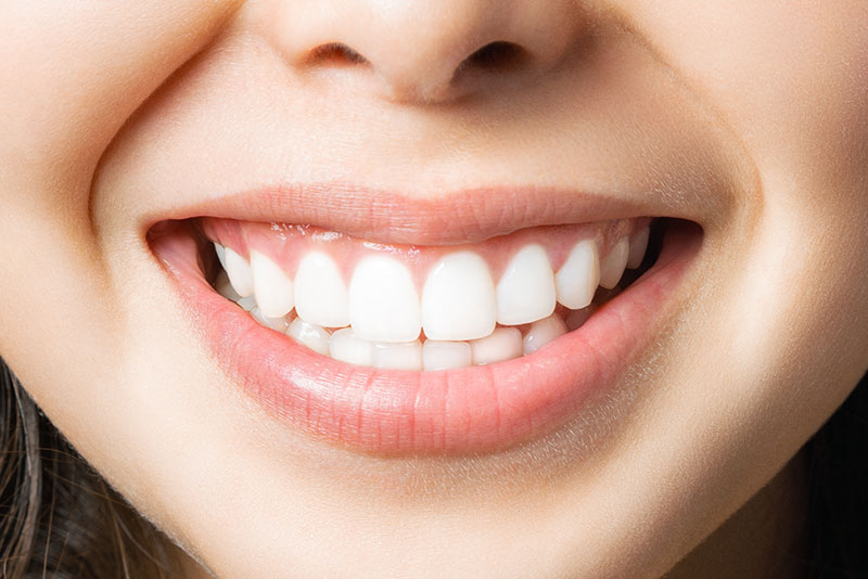 歯ぐきの黒ずみの治療：ガムピーリング